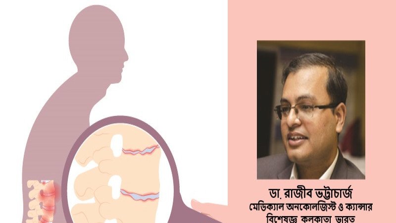 মাল্টিপল মায়োলোমা কি হাড়ের ক্যান্সার? জানালেন বিশেষজ্ঞ চিকিৎসক