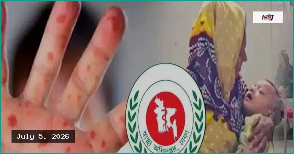 দেশে হাম ও উপসর্গে গত ২৪ ঘণ্টায় আরও ৭ শিশুর মৃত্যু
