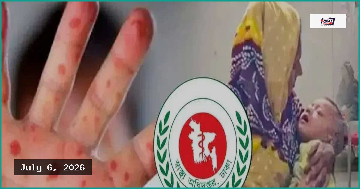 দেশে ২৪ ঘণ্টায় হামের উপসর্গে আরও তিন শিশুর মৃত্যু