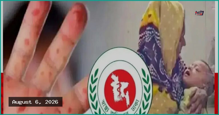 দেশে হাম ও উপসর্গে আরও ৬ শিশুর মৃত্যু, আক্রান্ত ৮৬০