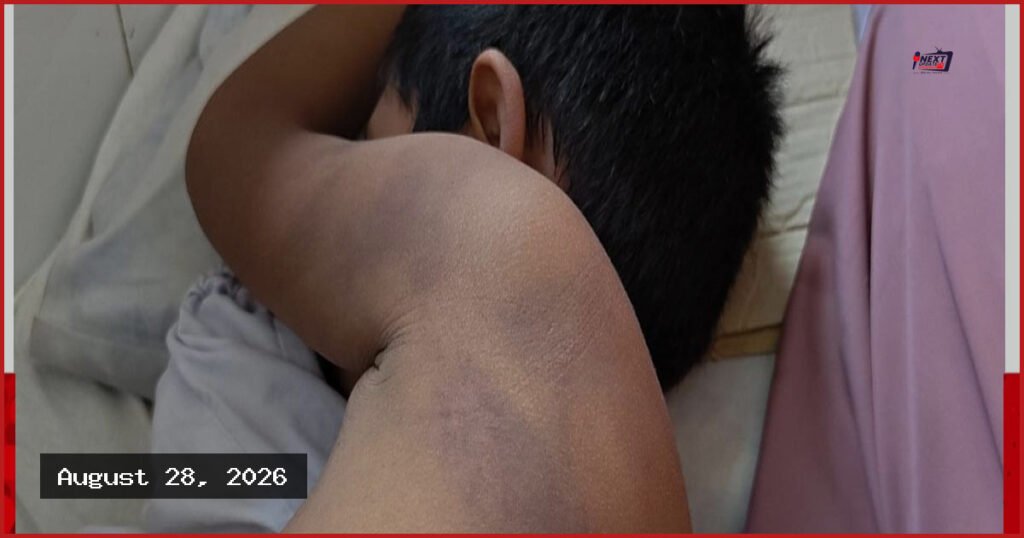 শরণখোলায় মাদ্রাসা শিক্ষকের মারধরে শিক্ষার্থী হাসপাতালে ভর্তি
