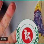 দেশে হামের প্রকোপ: ২৪ ঘণ্টায় আরও ৬ শিশুর মৃত্যু