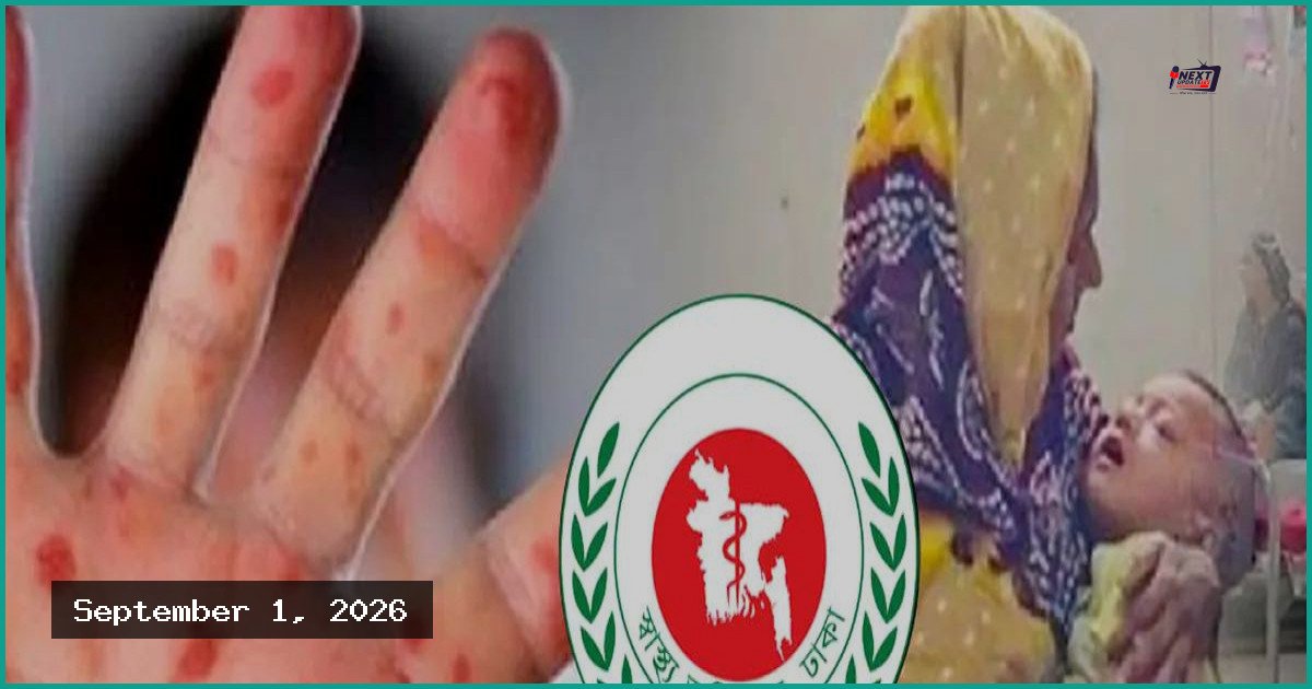 দেশে হামের প্রকোপ: ২৪ ঘণ্টায় আরও ৬ শিশুর মৃত্যু
